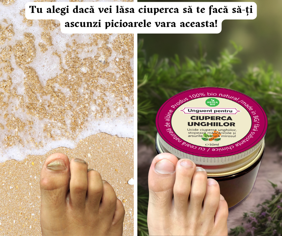 Unguent pe bază de plante împotriva ciupercii unghiilor